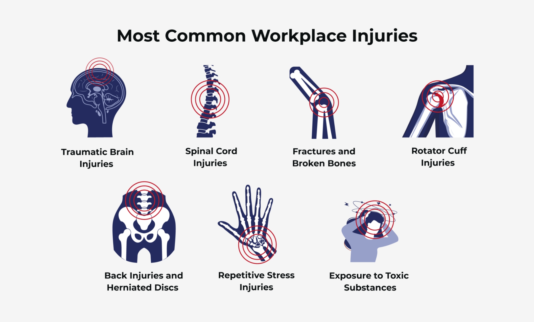 most common workplace injuries