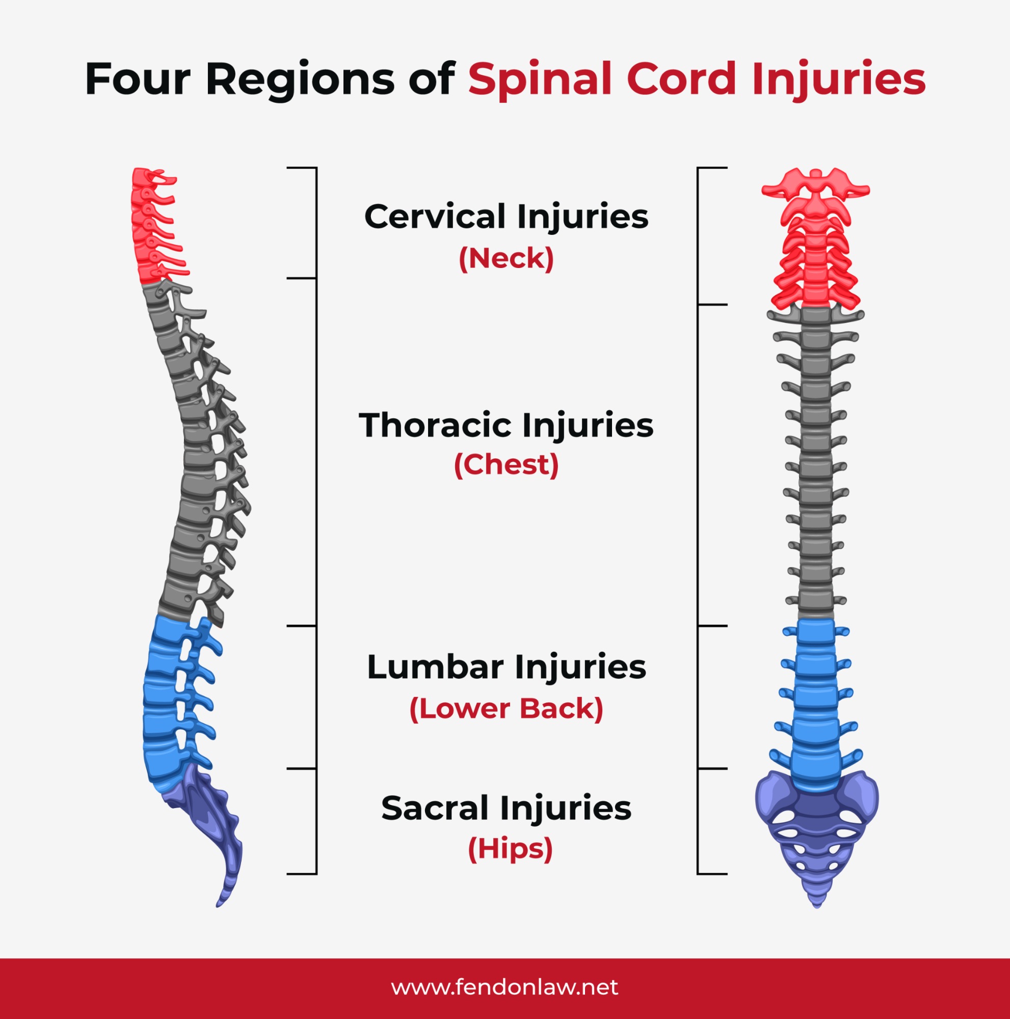four regions of spinal cord injuries