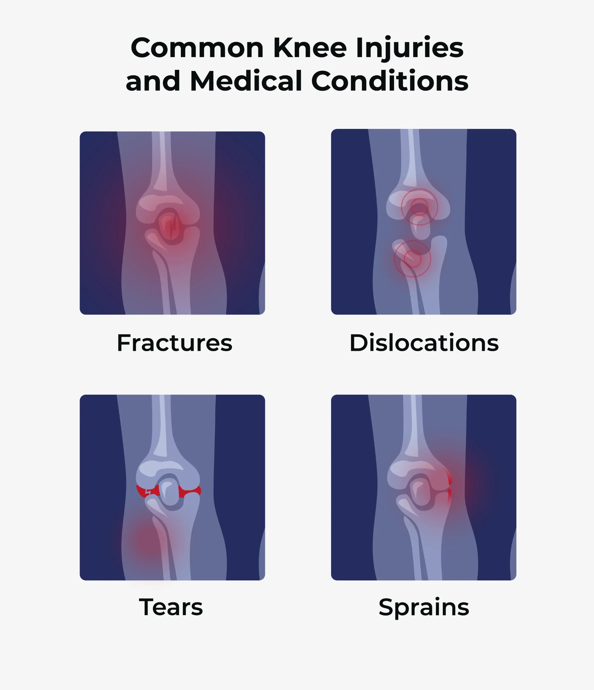 common knee injuries and medical conditions