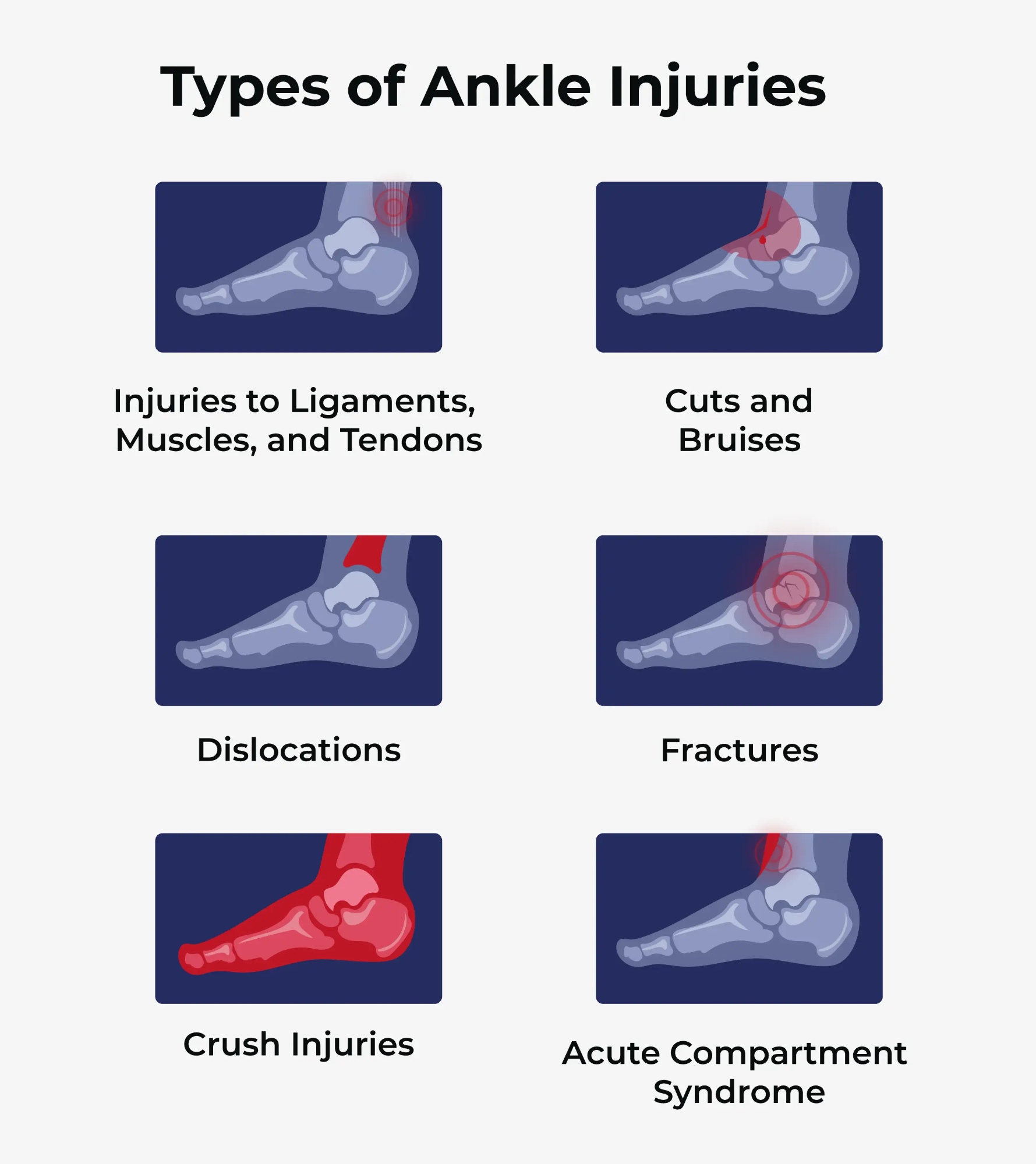 types of ankle injuries