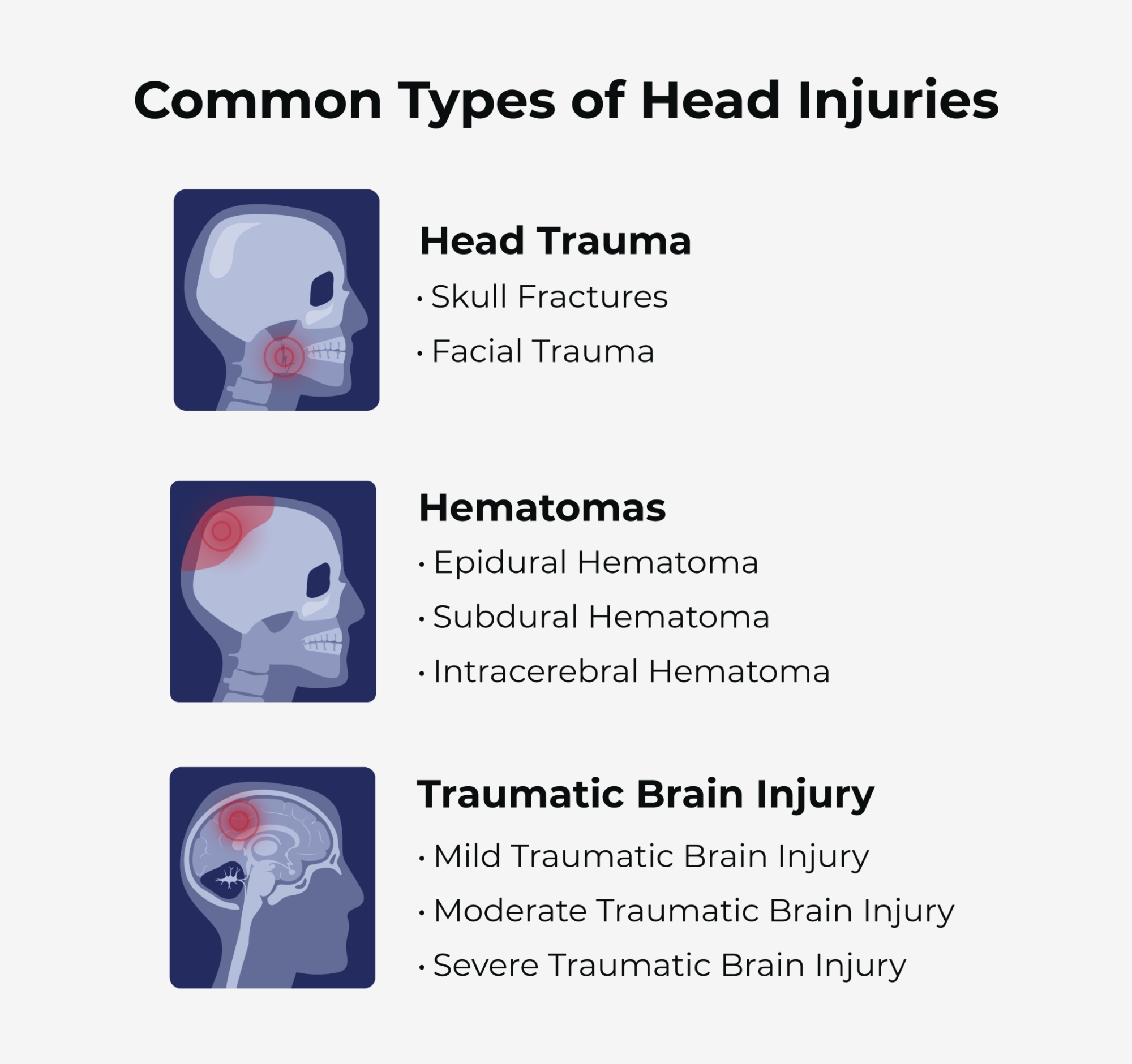 Common types of head injuries