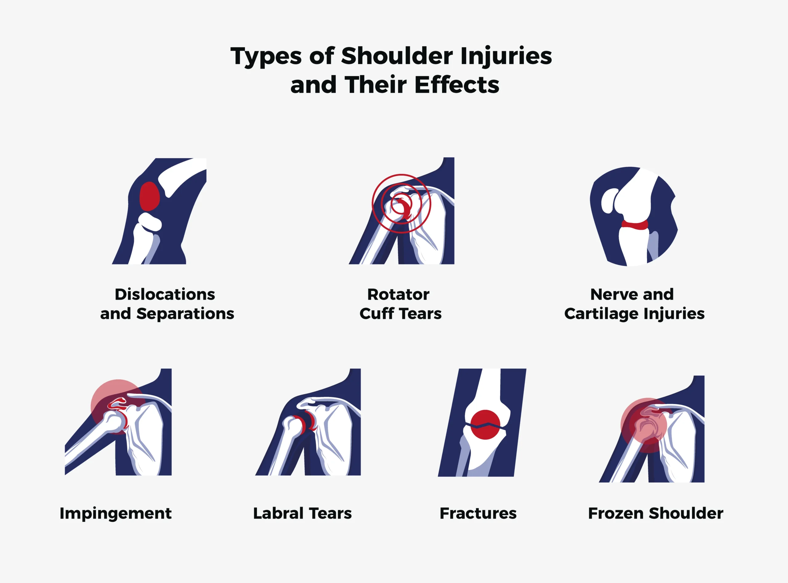 types of shoulder injuries and their effects