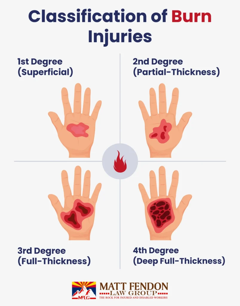 Classification of Burn Injuries